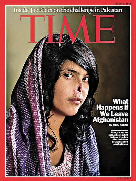 阿富汗割鼻少女, TIME時代雜誌